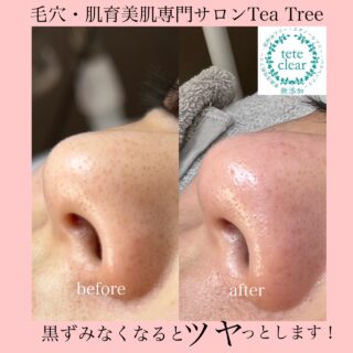 ビフォー・アフター